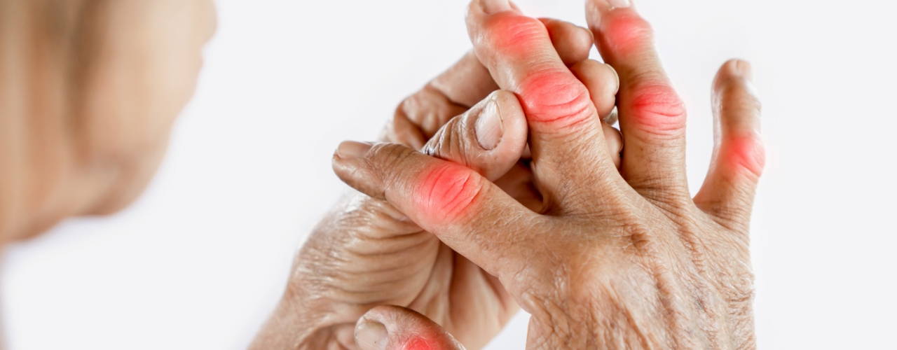 arthritis-pain-relief-long-island-physical-therapy-huntington-station-ny